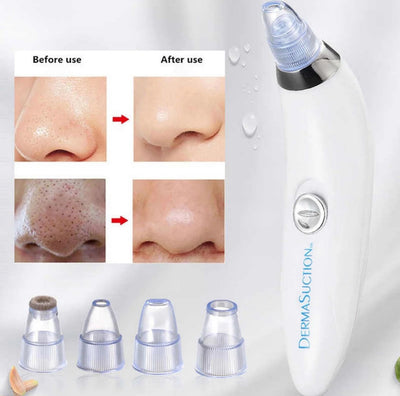Derma Suction Blackhead Remover